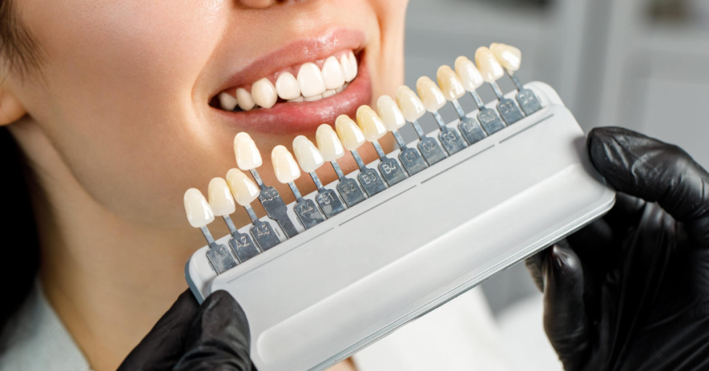 Benefits of Durable Porcelain Dental Crowns