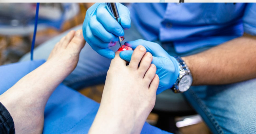 Fast and Effective Toenail Fungus Laser Treatment