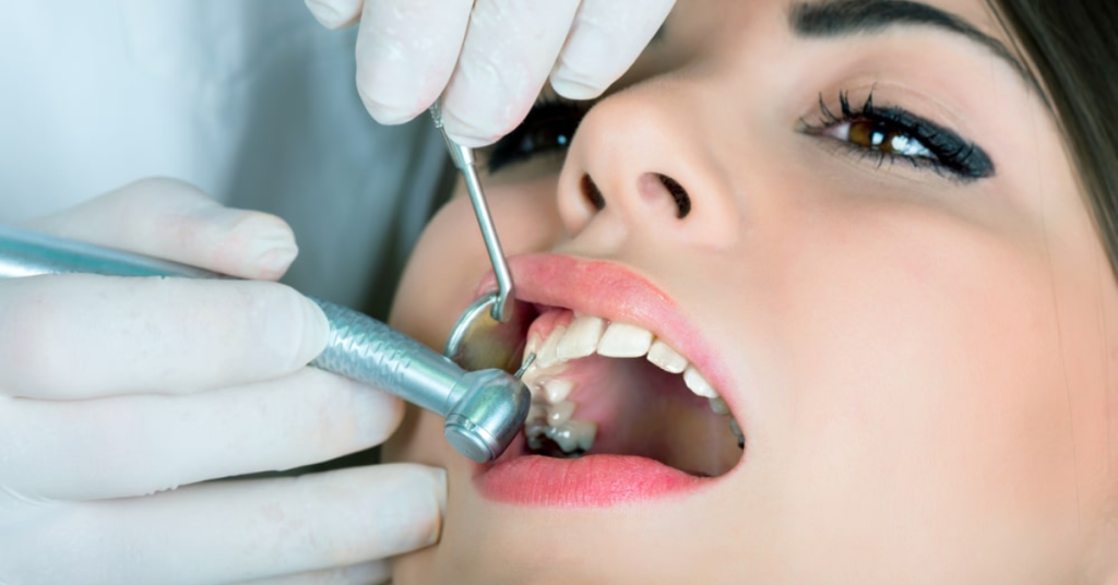 Affordable Single Tooth Implants in NYC