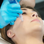 SkinPen Microneedling: A Guide to Youthful Skin